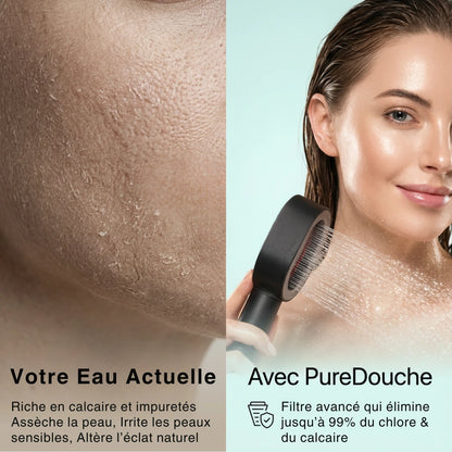 PureDouche® : Stoppez les dégâts invisibles causés par votre eau. Ce pommeau révolutionnaire filtre ce que votre peau n’a jamais supporté.