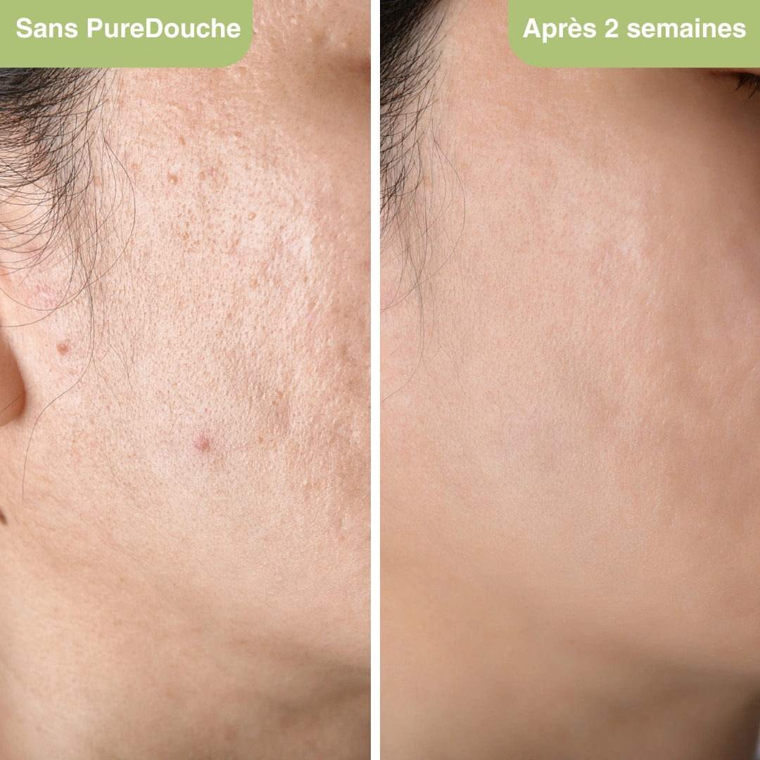 Filtra® : Il filtre jusqu’à 99% du calcaire, chlore et impuretés, pour une peau apaisée et des cheveux éclatants