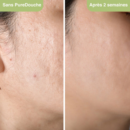 Filtra® : Il filtre jusqu’à 99% du calcaire, chlore et impuretés, pour une peau apaisée et des cheveux éclatants